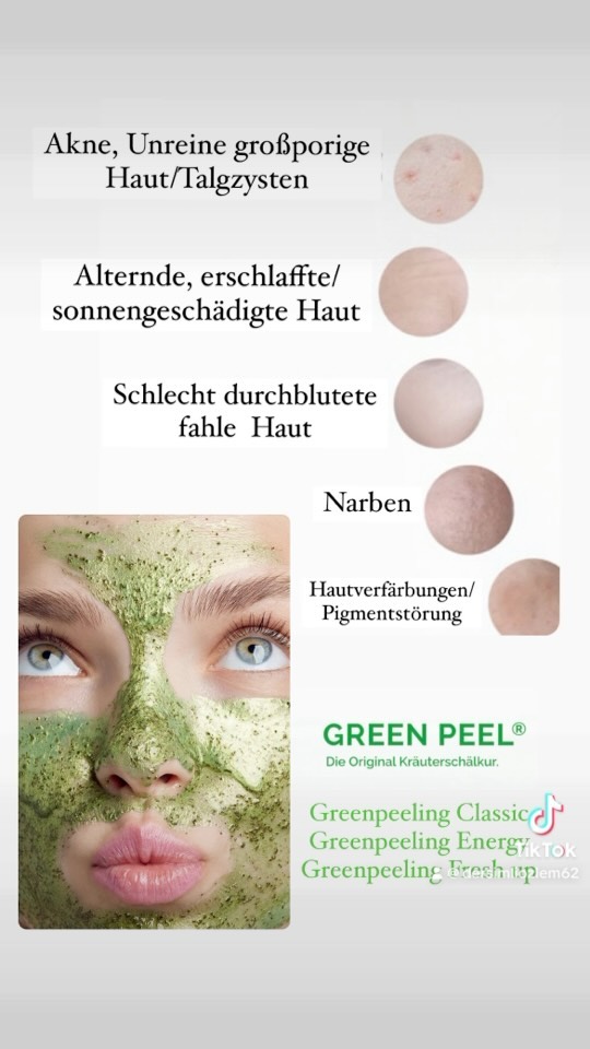 Ich liebe meinen #job??????? work #foryoupage #fypppppppp #viral #aknebehandlung #unreinehaut #schönehautistkeinzufall #schönehaut #durchblutungsförderung #antipigmentation #antoaging #salzburg #salzburgland #männer #frauen #woman #man #foryoupage #beauty #trend